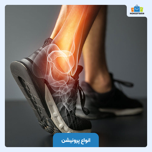 انواع پرونیشن