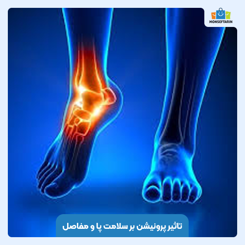 تاثیر پرونیشن بر سلامت پا و مفاصل